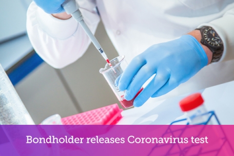 Bondholder releases Coronavirus test
